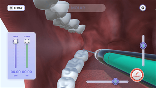 牙医模拟器截图4